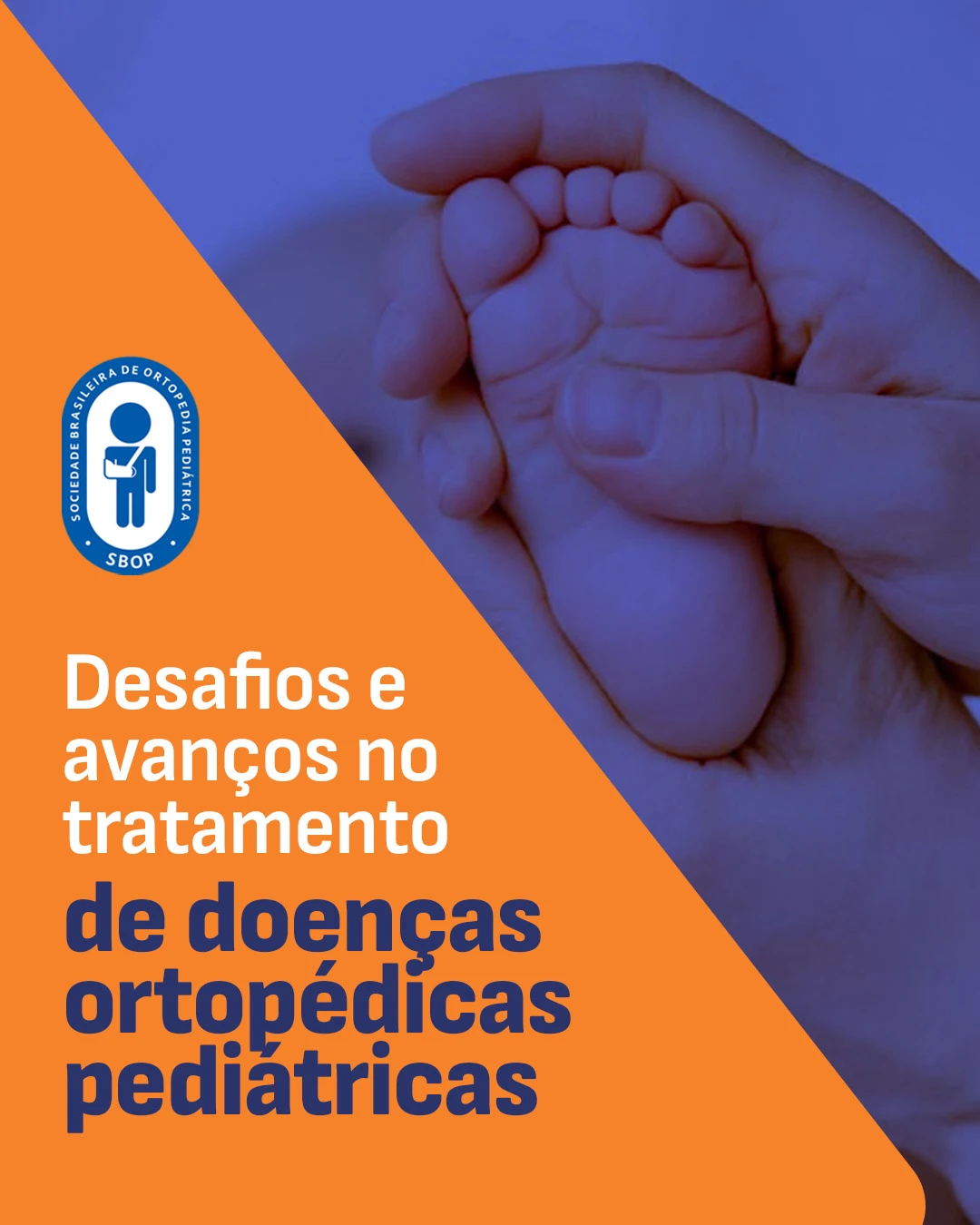 Desafios e avanços no tratamento de doenças ort. pediátricas