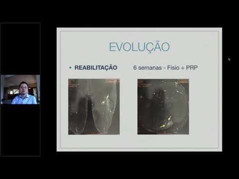Lesões Musculares